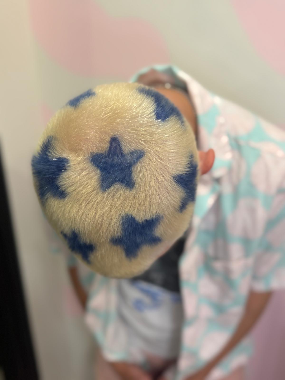 unnamed image